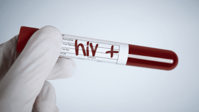 تحليل فيروس نقص المناعة HIV الايدز